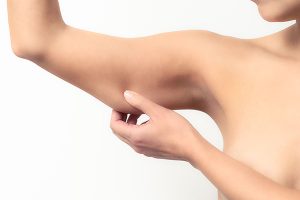 arm liposuction procedure